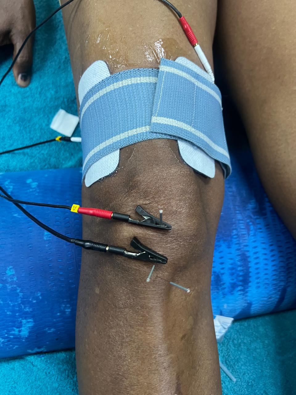 Sports Injury Physiotherapy